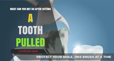 Post-Extraction Care: Activities to Avoid After a Tooth Extraction