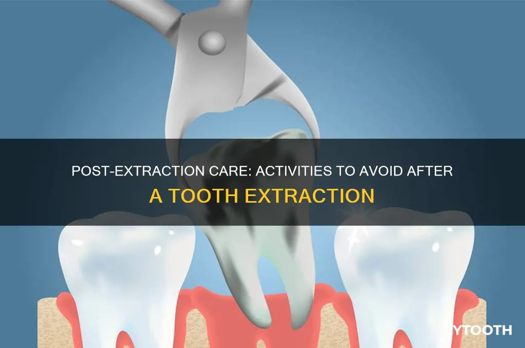 what can you not do after getting a tooth pulled