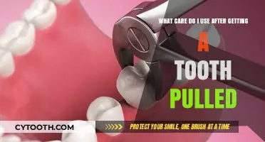 Post-Extraction Care: Essential Tips for Healing After a Tooth Extraction