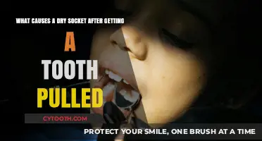 Understanding Dry Socket: Causes and Prevention After Tooth Extraction