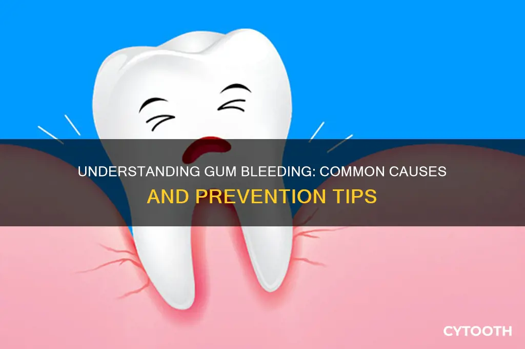 what causes gum bleeding