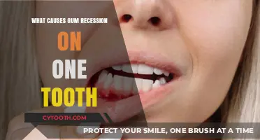 Uncovering the Root Causes of Gum Recession on a Single Tooth