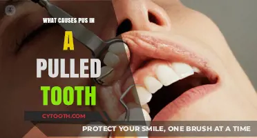Pulled Tooth Pus: Causes, Risks, and Prevention Explained