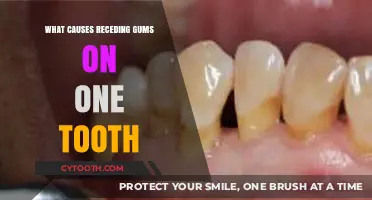 Uncovering the Root Cause of Receding Gums on a Single Tooth