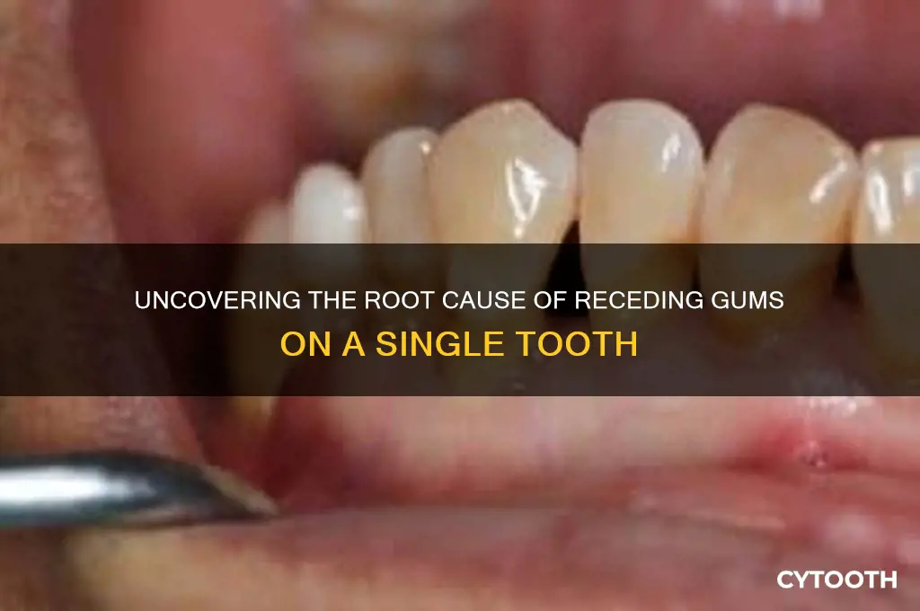 what causes receding gums on one tooth