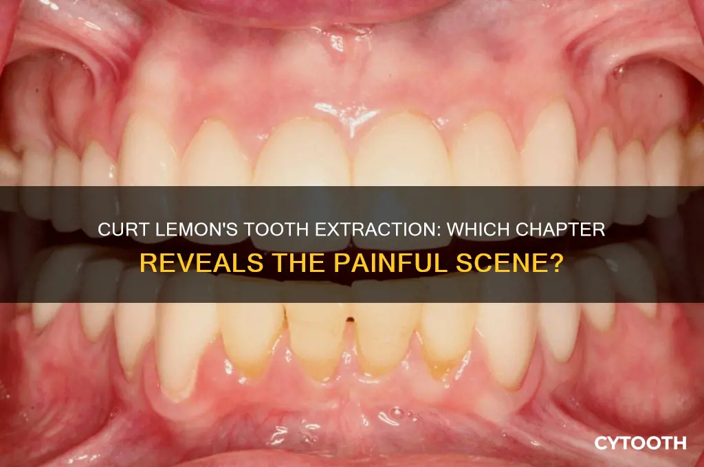what chapter does curt lemon get tooth pulled out