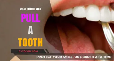Who Extracts Teeth? Understanding Which Dentist Pulls a Tooth