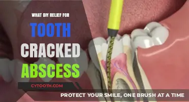 DIY Remedies for Cracked Tooth Abscess Relief at Home