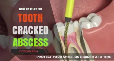 DIY Remedies for Cracked Tooth Abscess Relief at Home