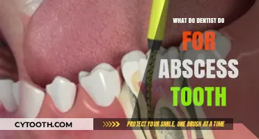 Treating Abscessed Teeth: Essential Dental Procedures and Care Explained
