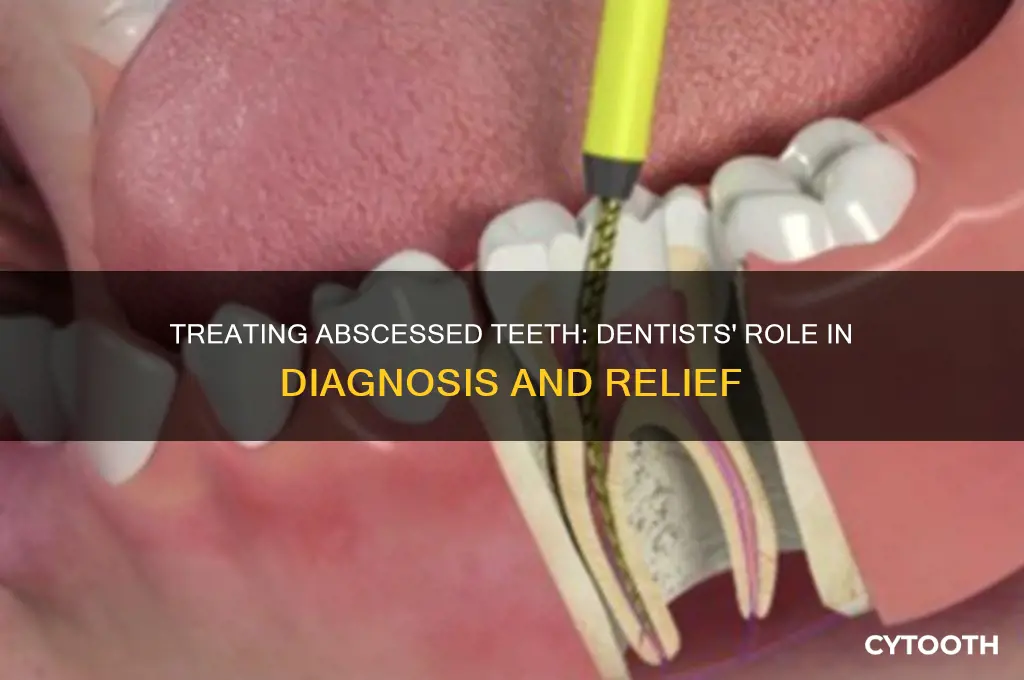 what do dentist do for abscess tooth