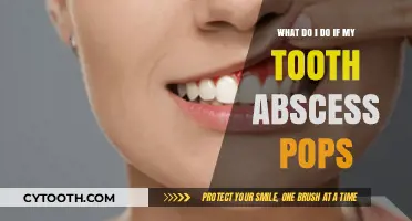 Tooth Abscess Popped? Immediate Steps to Take for Relief and Recovery