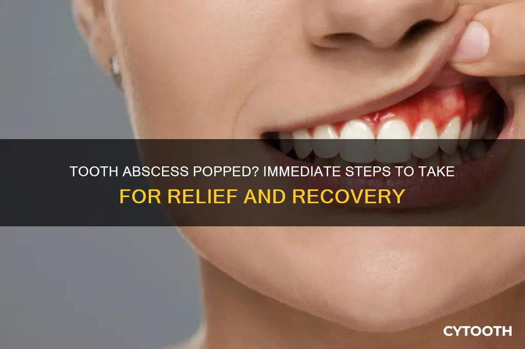 what do i do if my tooth abscess pops