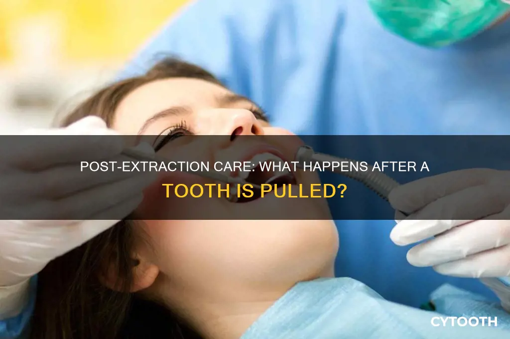 what do they do after they pull a tooth