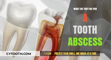Effective Treatments for Tooth Abscess: What Dentists Do to Relieve Pain