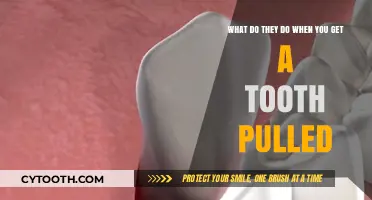 Tooth Extraction Process: What Happens When You Get a Tooth Pulled