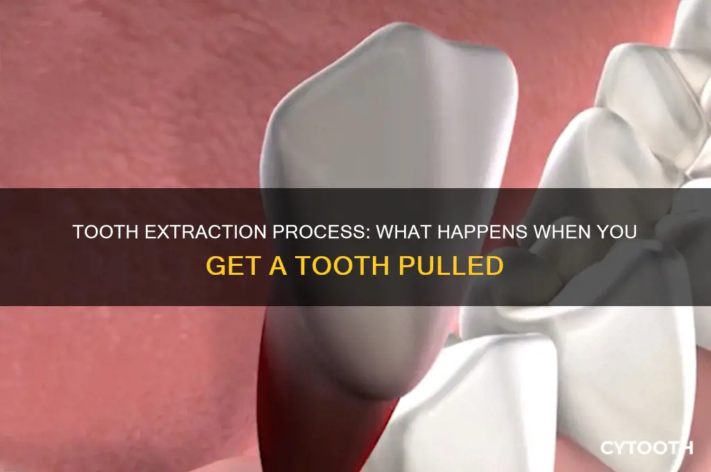 what do they do when you get a tooth pulled