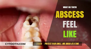 Understanding Tooth Abscess Pain: Symptoms, Sensations, and Relief Tips