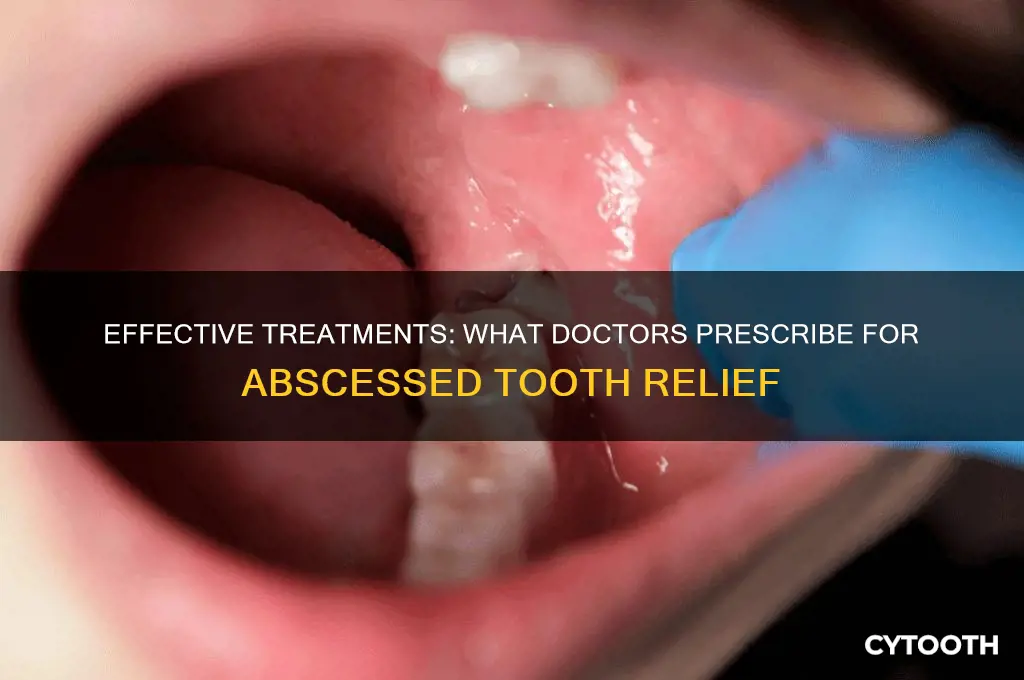 what doctors perscribe for abscessed tooth