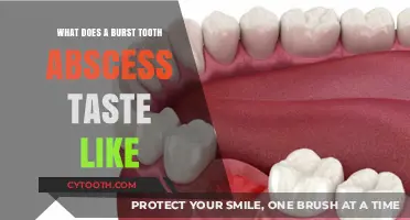 Unpleasant Taste of a Burst Tooth Abscess: What to Expect
