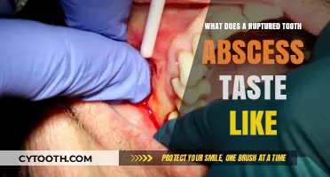 Unpleasant Taste of a Ruptured Tooth Abscess: What to Expect