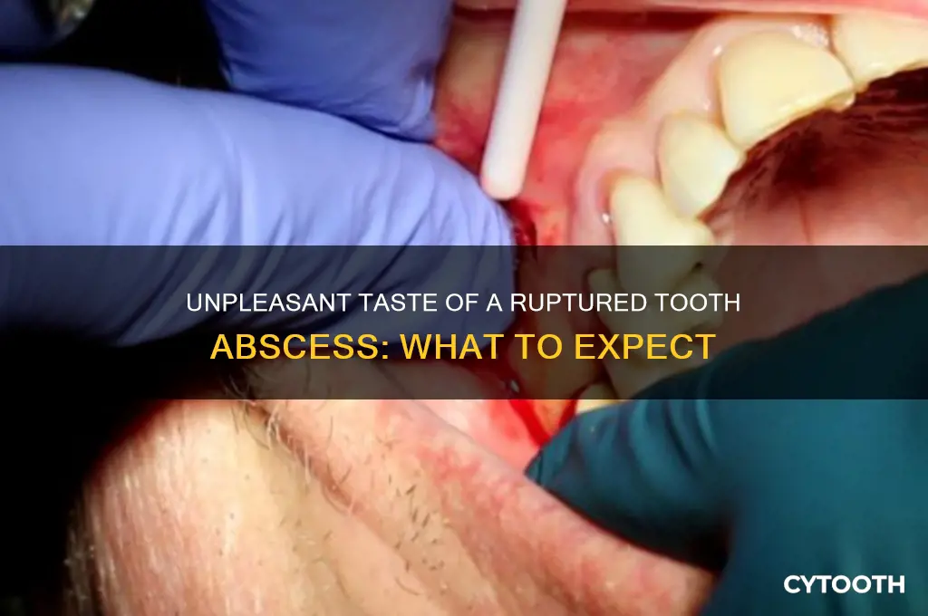 what does a ruptured tooth abscess taste like