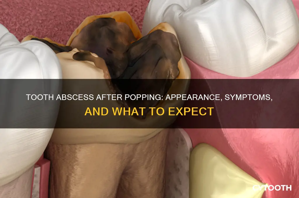 what does a tooth abscess look like after it pops