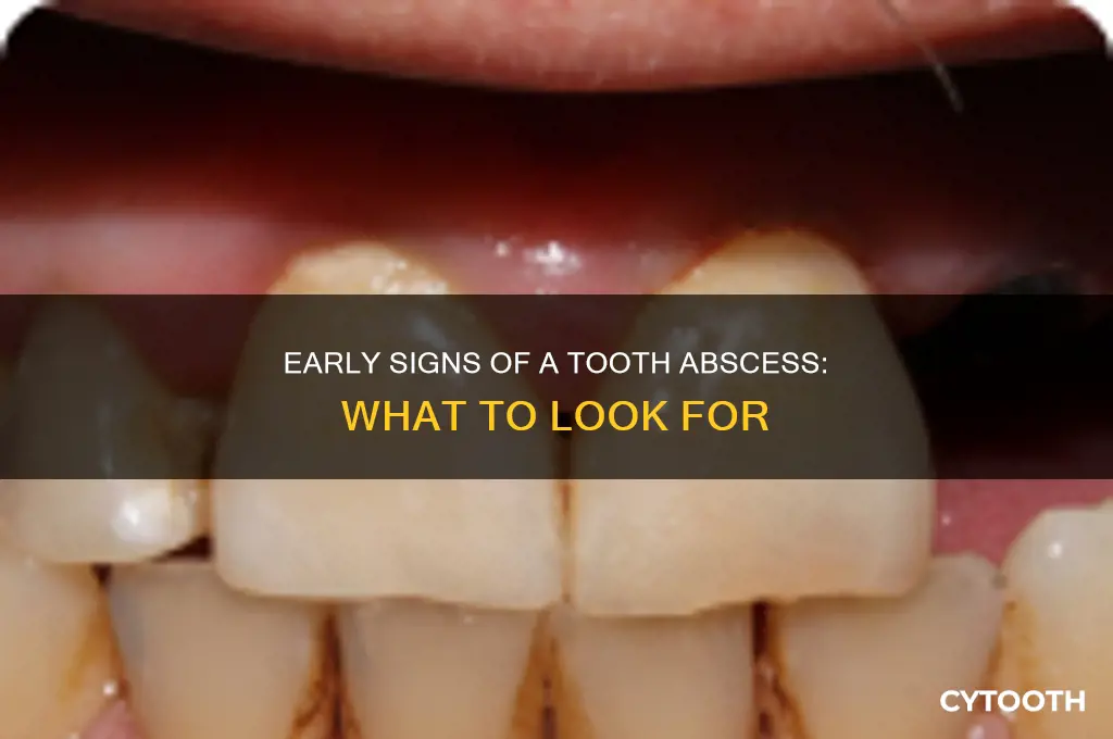 what does a tooth abscess look like early stages