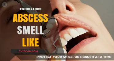 Unpleasant Odor of a Tooth Abscess: What to Expect and Why
