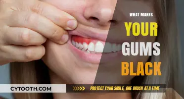 Why Are My Gums Black? Causes, Concerns, and Solutions Explained