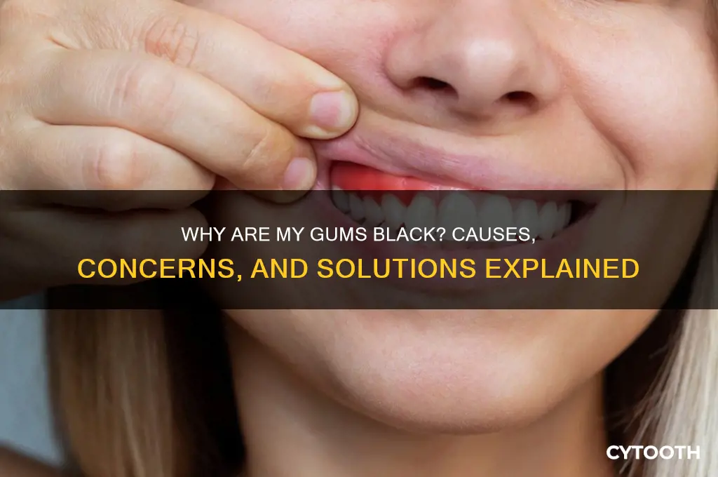 what makes your gums black