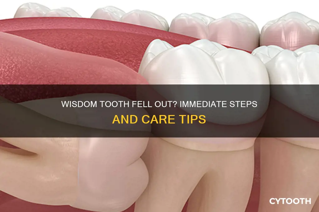 what to do if a wisdom tooth falls out