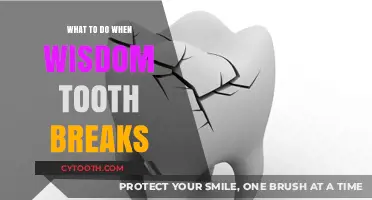Broken Wisdom Tooth? Immediate Steps and Remedies for Quick Relief