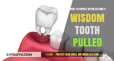 Wisdom Tooth Removal Recovery: What to Expect Post-Extraction