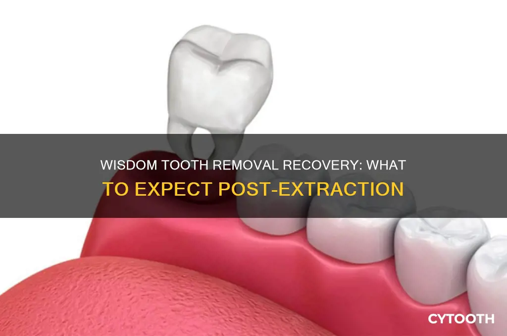 what to expect after getting a wisdom tooth pulled