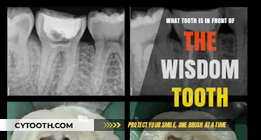 Identifying the Tooth Located Just in Front of Your Wisdom Tooth