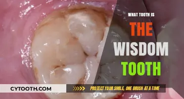 Understanding Wisdom Teeth: Location, Purpose, and Common Concerns