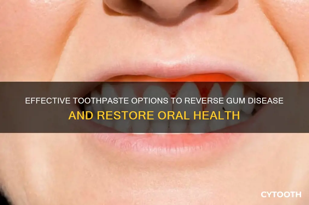 what toothpaste reverses gum disease