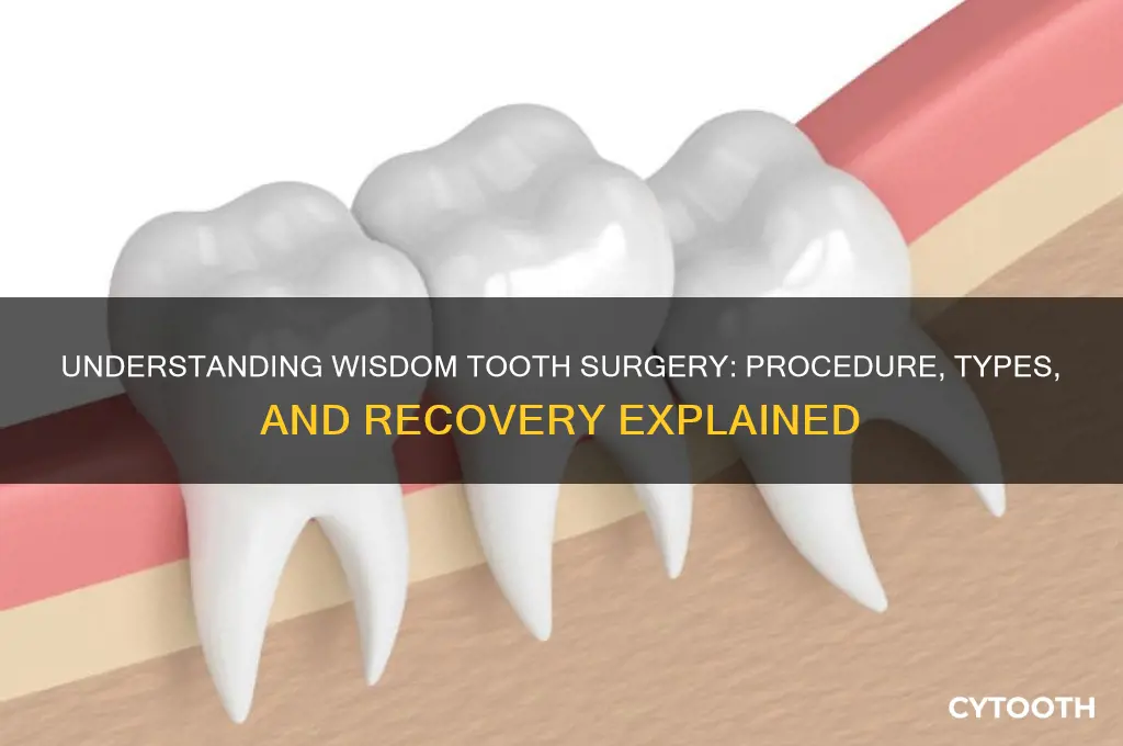 what tyoe of surgery is wisdom tooth surgery