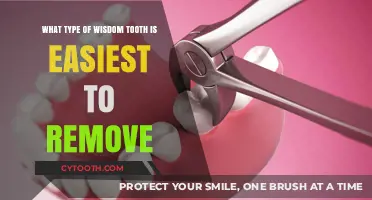 Easiest Wisdom Tooth Extraction: Which Type Requires Less Effort?