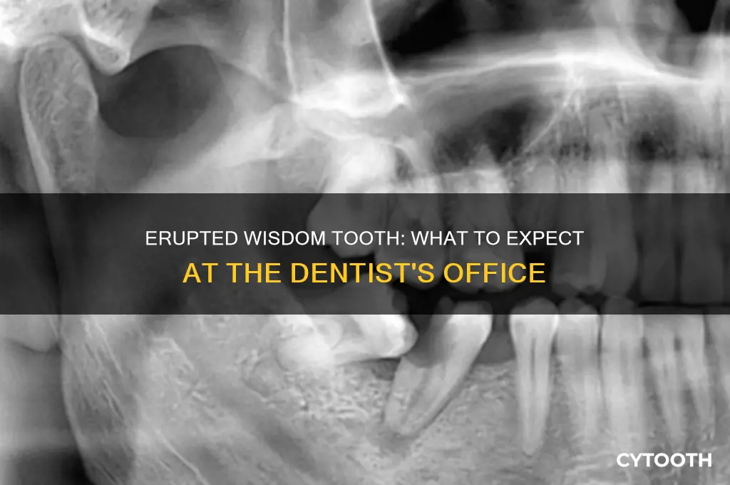 what will a dentist do for an erupted wisdom tooth