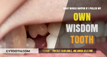 DIY Wisdom Tooth Extraction: Risks, Consequences, and Why It's a Bad Idea