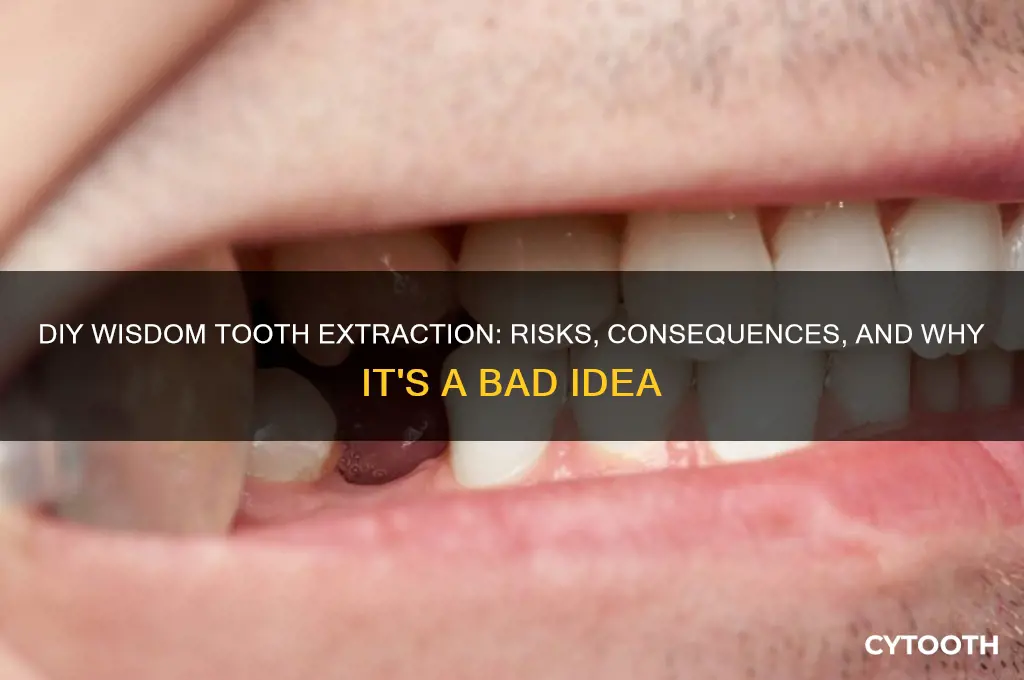 what would happen if i pulled my own wisdom tooth