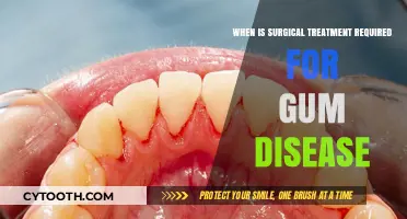 Surgical Treatment for Gum Disease: When Is It Necessary?