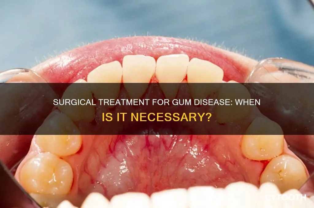 when is surgical treatment required for gum disease