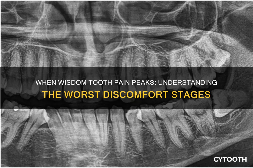 when is wisdom tooth pain the worst