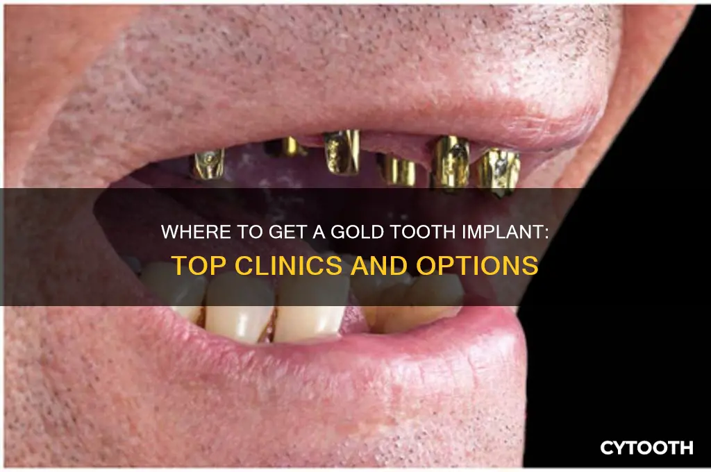 where can i get a gold tooth implant