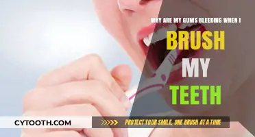 Bleeding Gums While Brushing? Causes, Prevention, and Oral Health Tips