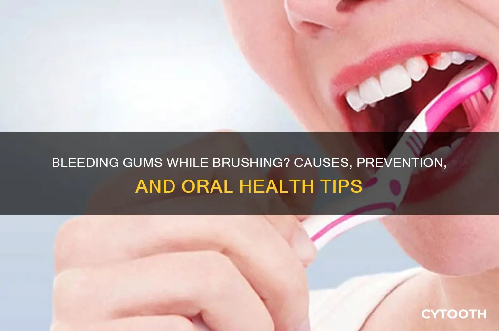 why are my gums bleeding when i brush my teeth