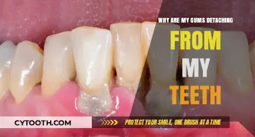 Why Are My Gums Detaching? Causes and Solutions Explained